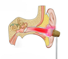 Load image into Gallery viewer, LIGHTFORCE RED LIGHT THERAPY EAR BUDS