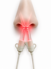 Load image into Gallery viewer, LIGHTFORCE RED &amp; NEAR INFRARED LED LIGHT THERAPY INTRANASAL DEVICE